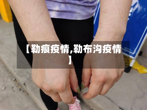 【勒痕疫情,勒布沟疫情】